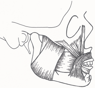 Buccinator kulkee poikittaisilla säikeillään suuta ympäröivän lihaksen ja alaleuan luun välissä. Tämän lihaksen tehtävänä on kontrolloida mm. ruuan siirtelyä suussa puremisen aikana. Onkin sanottu, että toistuva pureminen poskeen ruokailun yhteydessä saattaa olla yksi tämän lihaksen toimintahäiriön merkki  ruokailun yhteydessäprovosoituvan poskikivun lisäksi.