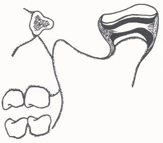 Piirros kuvaa vasenta leukaniveltä, joka halkaistu siten, että nähdään nivelen sisällä oleva välilevy. Sitä pidetään usein syyllisenä leukanivelen terävälle naksumiselle.