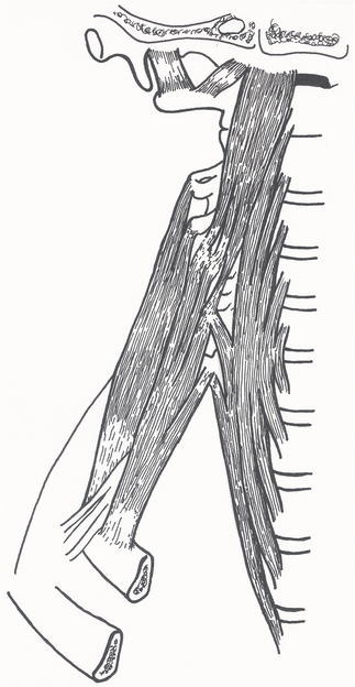 Piirroksessa kaularanka ja pari ylintä kylkiluuta. Scalenus anterior ja medius lihaksisto kulkevat kaularangasta ensimmäiseen ja ensimmäisen ja toiseen kylkiluun väliin. Niiden välistä puikkelehtii hartiahermopunos kohti yläraajaa.